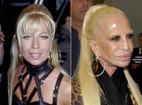 donatella versace com'era ieri e oggi|Donatella Versace ha messo fine all'era dell'himbo.